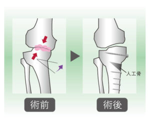 膝関節疾患に対する理学療法～変形性膝関節症を中心とした評価と治療～理学療法 Amazon.co.jp: 膝関節疾患に対する理学療法～変形性膝関節症を