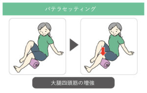 パテラセッティング