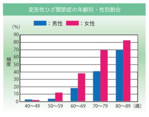 膝OA 年齢・性別グラフ