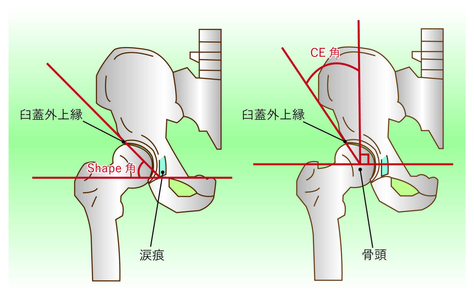 負荷の少ない有酸素運動