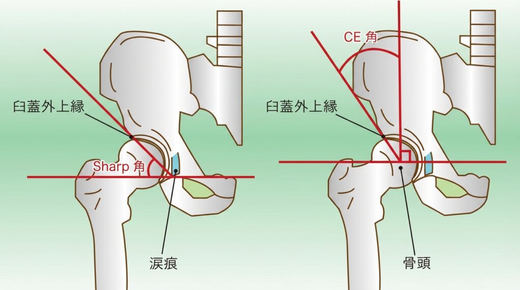 シャープ角　CE角
