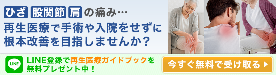 ひざ、肩、股関節の痛み　手術しない、新たな選択肢「再生医療」